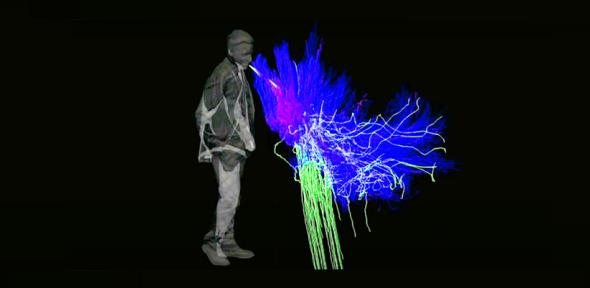 Visualisation of droplets from a cough