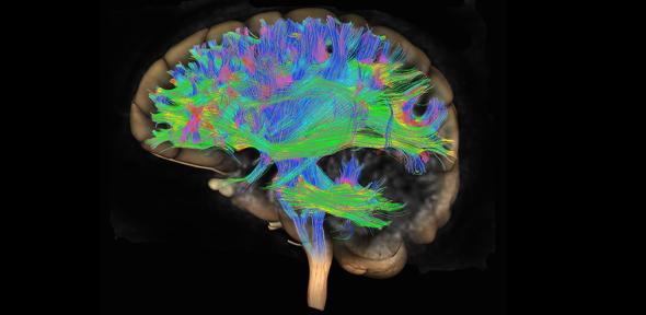 Diffusion tensor imaging (DTI) MRI of the human brain - stock photo